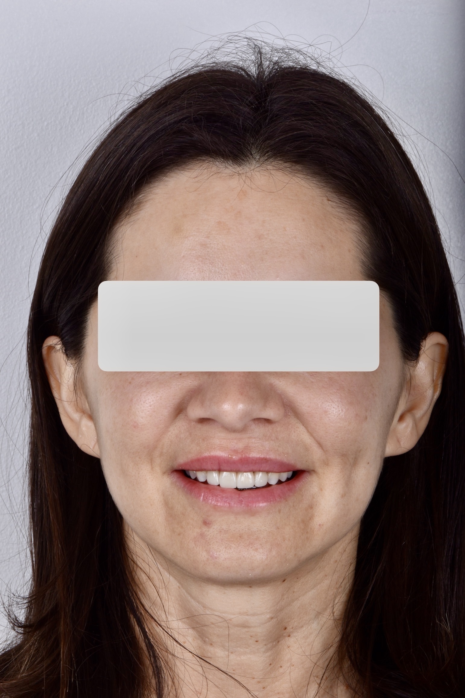 Resultado posterior al tratamiento